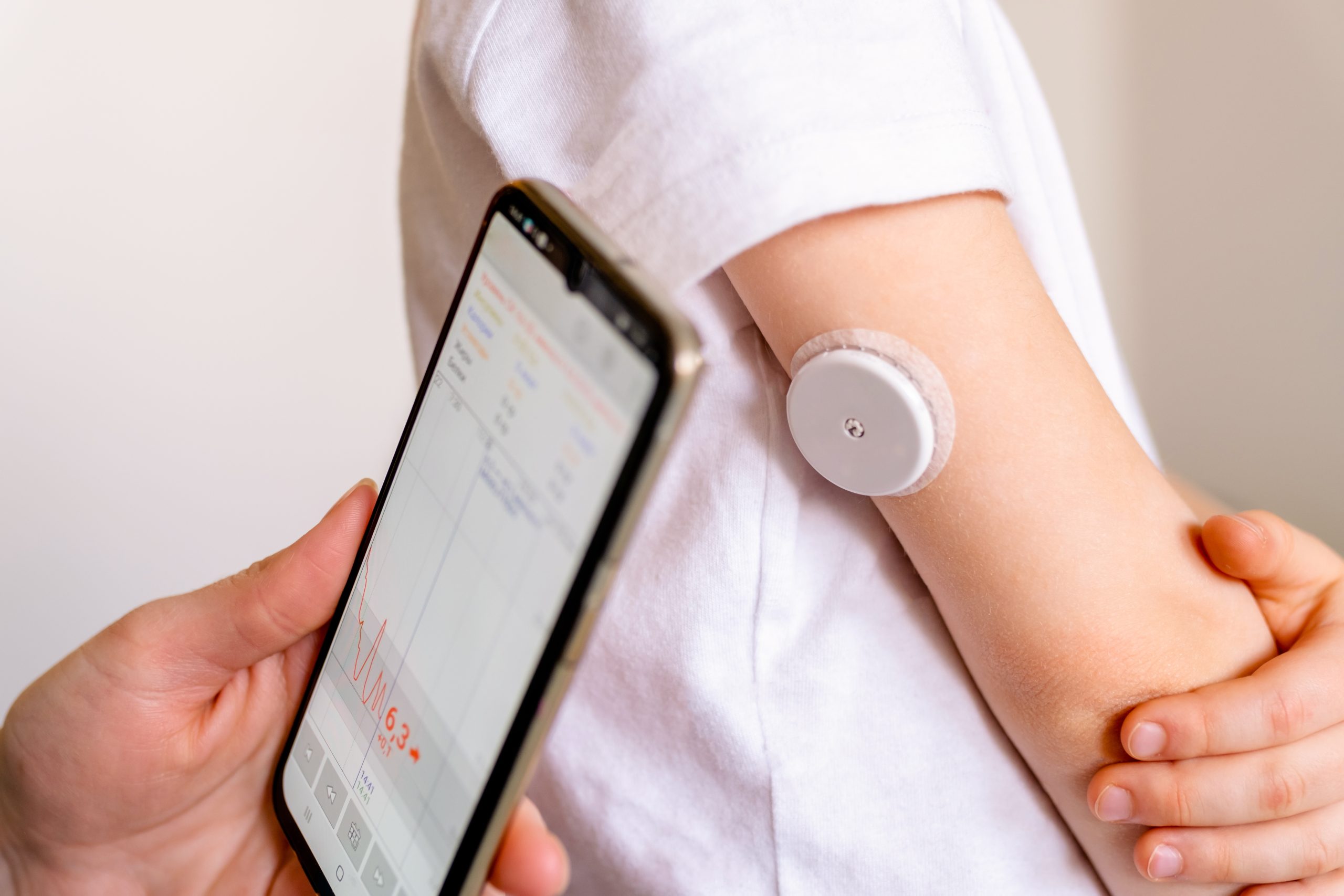 Blodsukker-sensor på en arm.