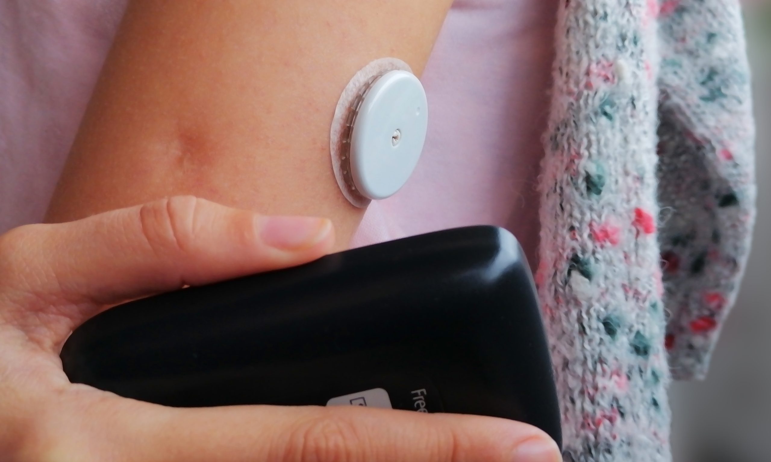 Blodsukker-sensor på en arm.